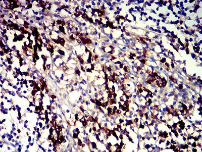 Immunohistochemistry (Formalin/PFA-fixed paraffin-embedded sections) - Anti-SLAMF7/CS1 antibody [5G5A4] (AB233779), expandable thumbnail