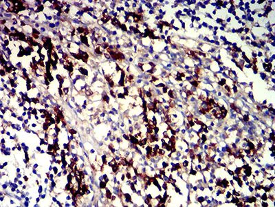 Immunohistochemistry (Formalin/PFA-fixed paraffin-embedded sections) - Anti-SLAMF7/CS1 antibody [5G5A4] (AB233779)