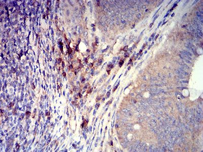 Immunohistochemistry (Formalin/PFA-fixed paraffin-embedded sections) - Anti-SLAMF7/CS1 antibody [5G5A4] (AB233779), expandable thumbnail
