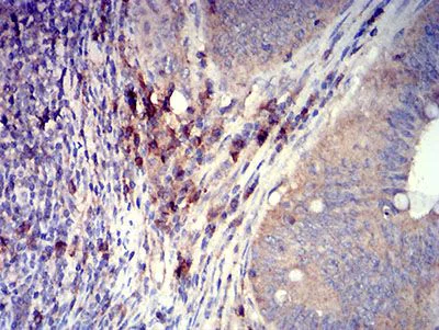 Immunohistochemistry (Formalin/PFA-fixed paraffin-embedded sections) - Anti-SLAMF7/CS1 antibody [5G5A4] (AB233779)