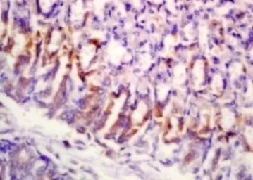 Immunohistochemistry (Formalin/PFA-fixed paraffin-embedded sections) - Anti-SLAMF7/CS1 antibody (AB202840)