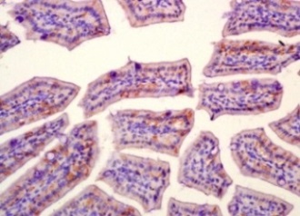 Immunohistochemistry (Formalin/PFA-fixed paraffin-embedded sections) - Anti-SLAMF7/CS1 antibody (AB202840), expandable thumbnail