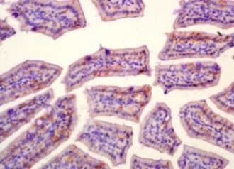 Immunohistochemistry (Formalin/PFA-fixed paraffin-embedded sections) - Anti-SLAMF7/CS1 antibody (AB202840)