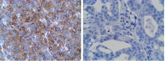 Immunohistochemistry (Formalin/PFA-fixed paraffin-embedded sections) - Anti-SLAMF7/CS1 antibody [CAL7] (AB237730)