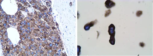 Immunohistochemistry (Formalin/PFA-fixed paraffin-embedded sections) - Anti-SLAMF7/CS1 antibody [CAL7] (AB237730)