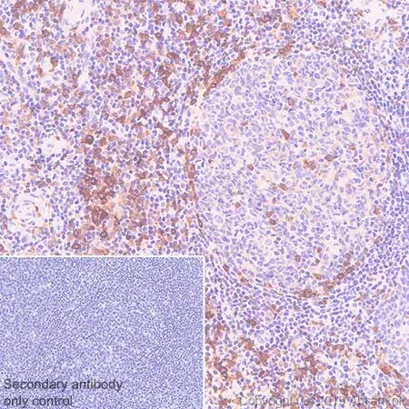 Immunohistochemistry (Formalin/PFA-fixed paraffin-embedded sections) - Anti-SLAMF7/CS1 antibody [CAL7] - BSA and Azide free (AB251615)