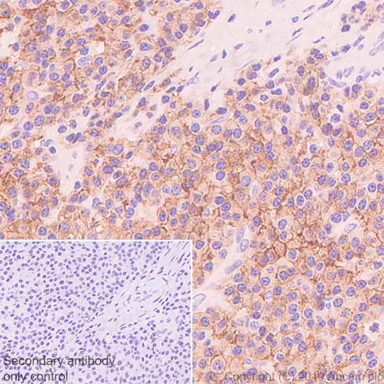 Immunohistochemistry (Formalin/PFA-fixed paraffin-embedded sections) - Anti-SLAMF7/CS1 antibody [CAL7] - BSA and Azide free (AB251615)