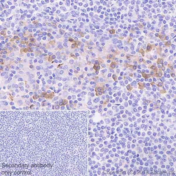 Immunohistochemistry (Formalin/PFA-fixed paraffin-embedded sections) - Anti-SLAMF7/CS1 antibody [EPR21155] (AB230945)