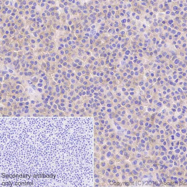 Immunohistochemistry (Formalin/PFA-fixed paraffin-embedded sections) - Anti-SLAMF7/CS1 antibody [EPR21155] (AB230945)