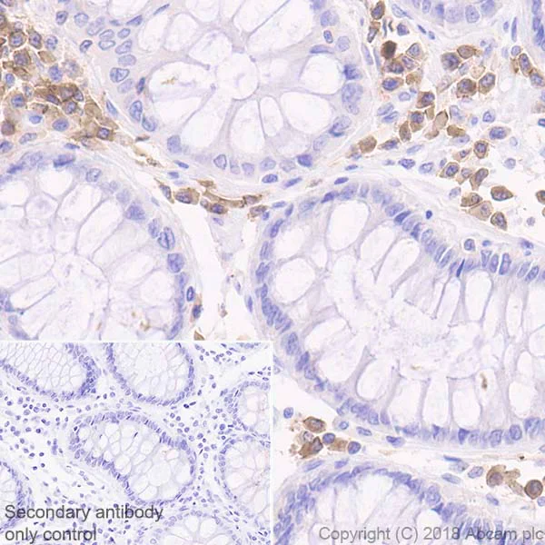 Immunohistochemistry (Formalin/PFA-fixed paraffin-embedded sections) - Anti-SLAMF7/CS1 antibody [EPR21155] (AB230945)