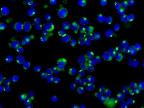 Immunocytochemistry/ Immunofluorescence - Anti-SLAP2 antibody [EPR8083(2)] - BSA and Azide free (AB249590), expandable thumbnail