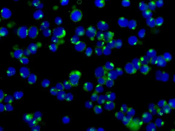 Immunocytochemistry/ Immunofluorescence - Anti-SLAP2 antibody [EPR8083(2)] - BSA and Azide free (AB249590)