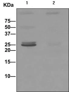 Immunoprecipitation - Anti-SLAP2 antibody [EPR8083(2)] - BSA and Azide free (AB249590)