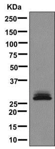Western blot - Anti-SLAP2 antibody [EPR8083(2)] - BSA and Azide free (AB249590)