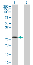 Western blot - SLAP2 overexpression 293T lysate (whole cell) (AB94209)