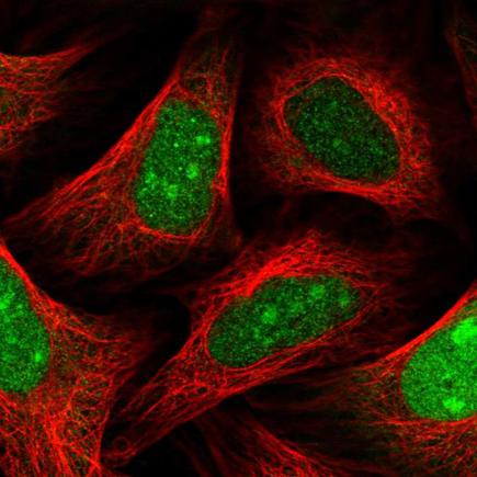 Immunocytochemistry/ Immunofluorescence - Anti-SLBP antibody (AB221166)