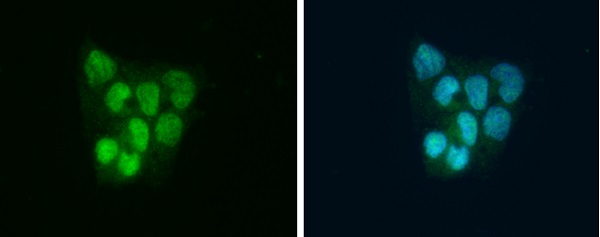 Immunocytochemistry/ Immunofluorescence - Anti-SLBP antibody (AB229677)