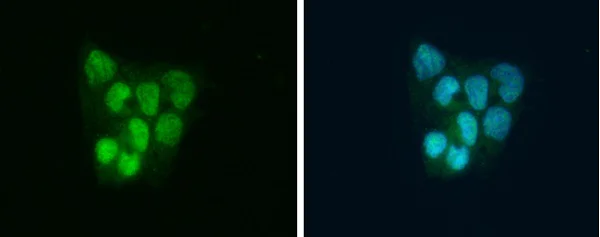 Immunocytochemistry/ Immunofluorescence - Anti-SLBP antibody (AB229677)