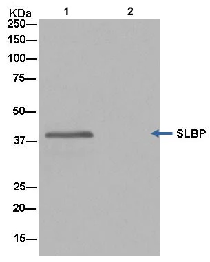 Immunoprecipitation - Anti-SLBP antibody [EPR12673] (AB181972)
