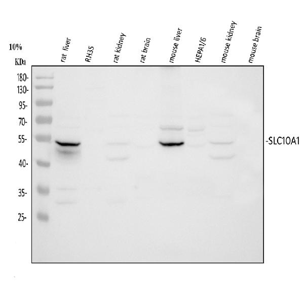 Anti-SLC10A1/NTCP1 antibody