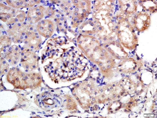 Immunohistochemistry (Formalin/PFA-fixed paraffin-embedded sections) - Anti-SLC10A1/NTCP1 antibody (AB203243)