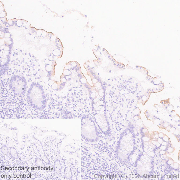 Immunohistochemistry (Formalin/PFA-fixed paraffin-embedded sections) - Anti-SLC10A2/ASBT antibody [EPR30870-526] (AB325793)