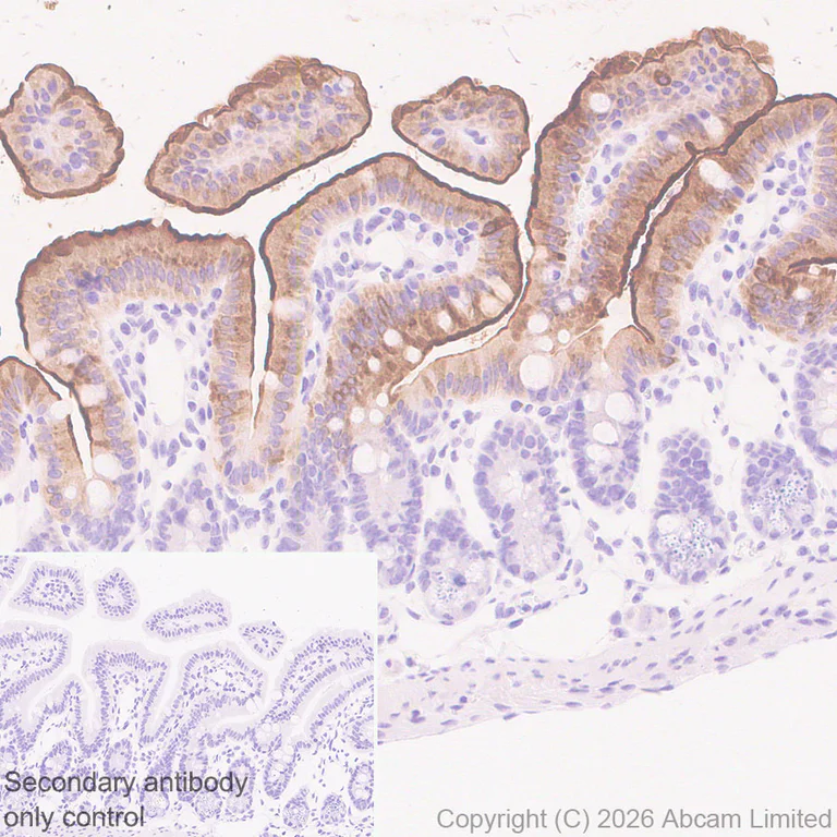 Immunohistochemistry (Formalin/PFA-fixed paraffin-embedded sections) - Anti-SLC10A2/ASBT antibody [EPR30870-526] (AB325793)