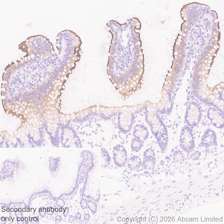 Immunohistochemistry (Formalin/PFA-fixed paraffin-embedded sections) - Anti-SLC10A2/ASBT antibody [EPR30870-526] (AB325793)