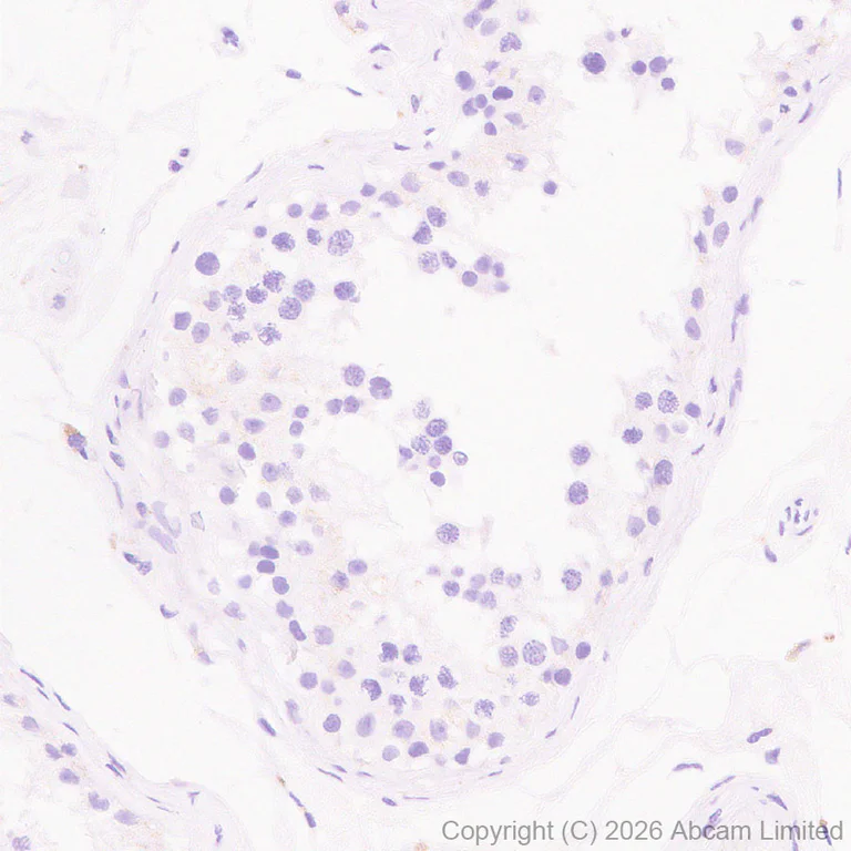 Immunohistochemistry (Formalin/PFA-fixed paraffin-embedded sections) - Anti-SLC10A2/ASBT antibody [EPR30870-526] (AB325793)