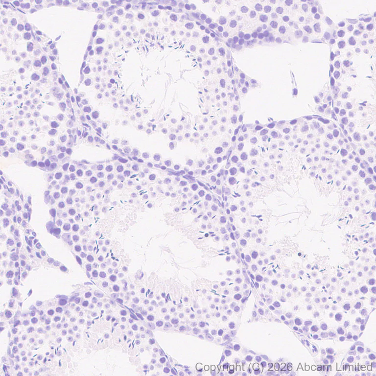 Immunohistochemistry (Formalin/PFA-fixed paraffin-embedded sections) - Anti-SLC10A2/ASBT antibody [EPR30870-526] (AB325793)