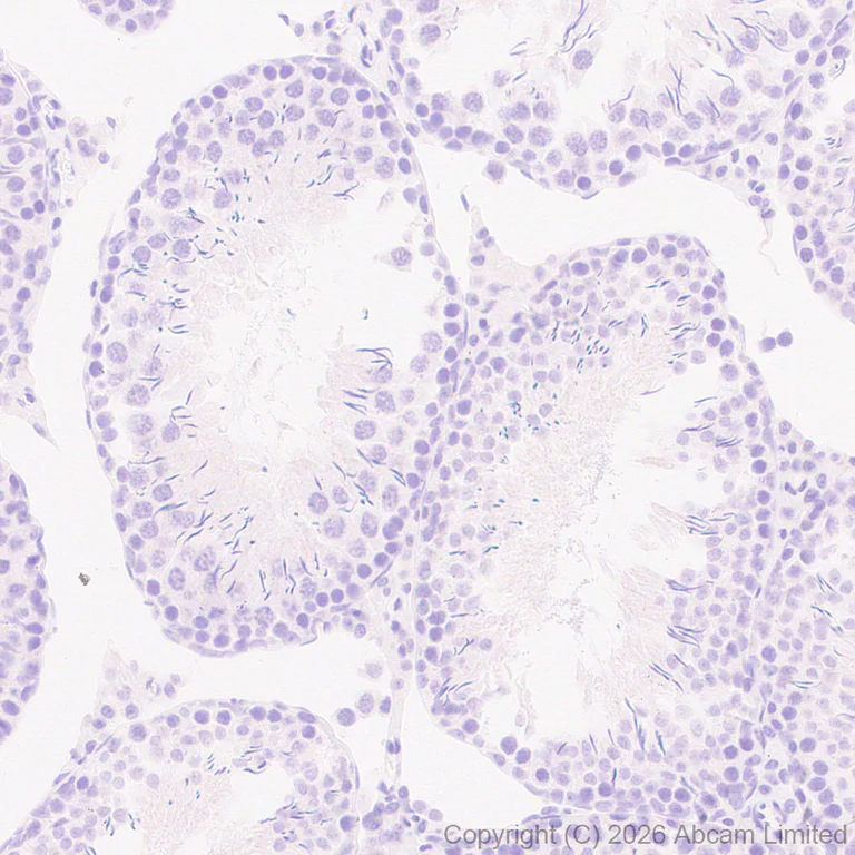 Immunohistochemistry (Formalin/PFA-fixed paraffin-embedded sections) - Anti-SLC10A2/ASBT antibody [EPR30870-526] (AB325793)