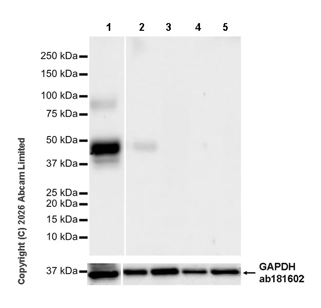 Western blot - Anti-SLC10A2/ASBT antibody [EPR30870-526] (AB325793)