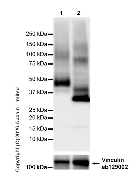 Western blot - Anti-SLC10A2/ASBT antibody [EPR30870-526] (AB325793)