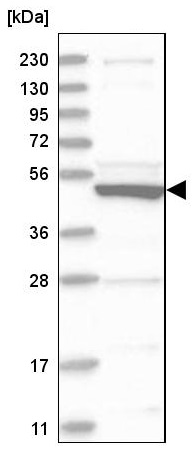 Western blot - Anti-SLC10A3 antibody (AB224438), expandable thumbnail