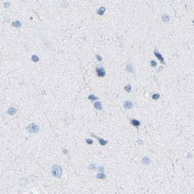 Immunohistochemistry (Formalin/PFA-fixed paraffin-embedded sections) - Anti-SLC12A1/NKCC2 antibody (AB244342), expandable thumbnail