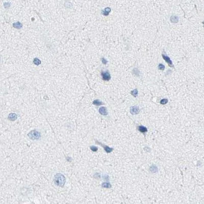 Immunohistochemistry (Formalin/PFA-fixed paraffin-embedded sections) - Anti-SLC12A1/NKCC2 antibody (AB244342)