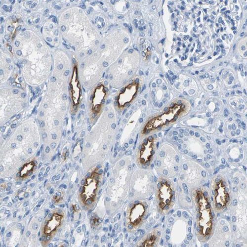 Immunohistochemistry (Formalin/PFA-fixed paraffin-embedded sections) - Anti-SLC12A1/NKCC2 antibody (AB244342), expandable thumbnail