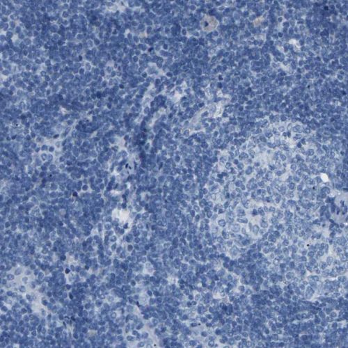 Immunohistochemistry (Formalin/PFA-fixed paraffin-embedded sections) - Anti-SLC12A1/NKCC2 antibody (AB244342), expandable thumbnail