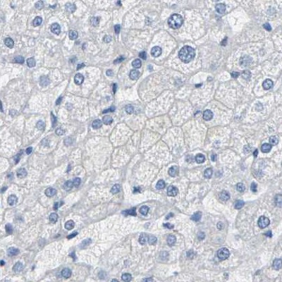 Immunohistochemistry (Formalin/PFA-fixed paraffin-embedded sections) - Anti-SLC12A1/NKCC2 antibody (AB244342), expandable thumbnail