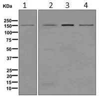 Western blot - Anti-SLC12A1/NKCC2 antibody [EPR11842] - BSA and Azide free (AB213653)