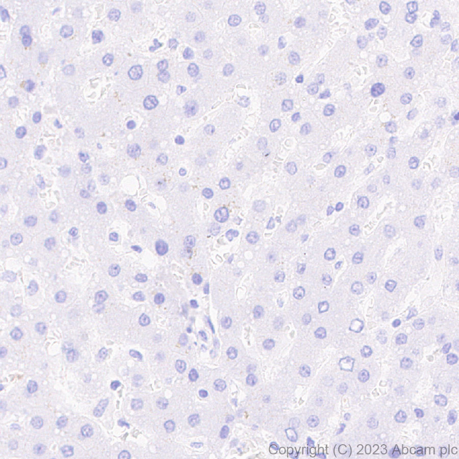 Immunohistochemistry (Formalin/PFA-fixed paraffin-embedded sections) - Anti-SLC12A1/NKCC2 antibody [EPR28176-90] (ab313640), expandable thumbnail