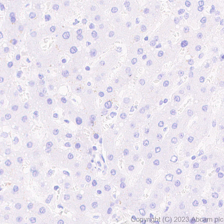 Immunohistochemistry (Formalin/PFA-fixed paraffin-embedded sections) - Anti-SLC12A1/NKCC2 antibody [EPR28176-90] (AB313640)