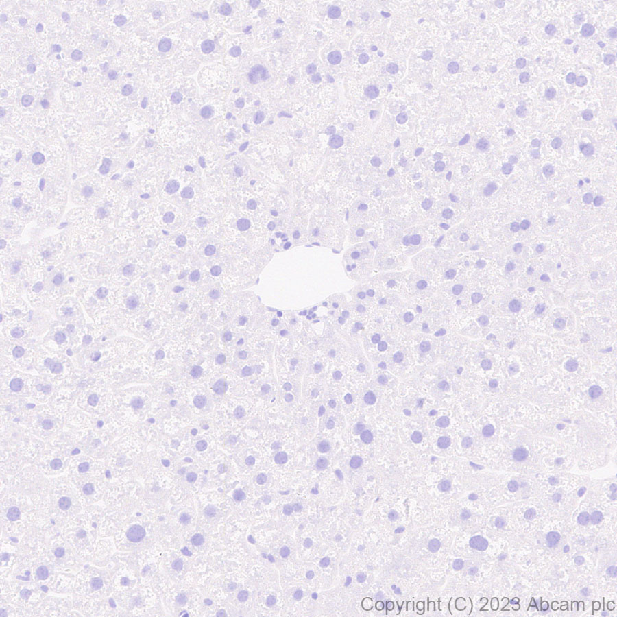 Immunohistochemistry (Formalin/PFA-fixed paraffin-embedded sections) - Anti-SLC12A1/NKCC2 antibody [EPR28176-90] (ab313640), expandable thumbnail