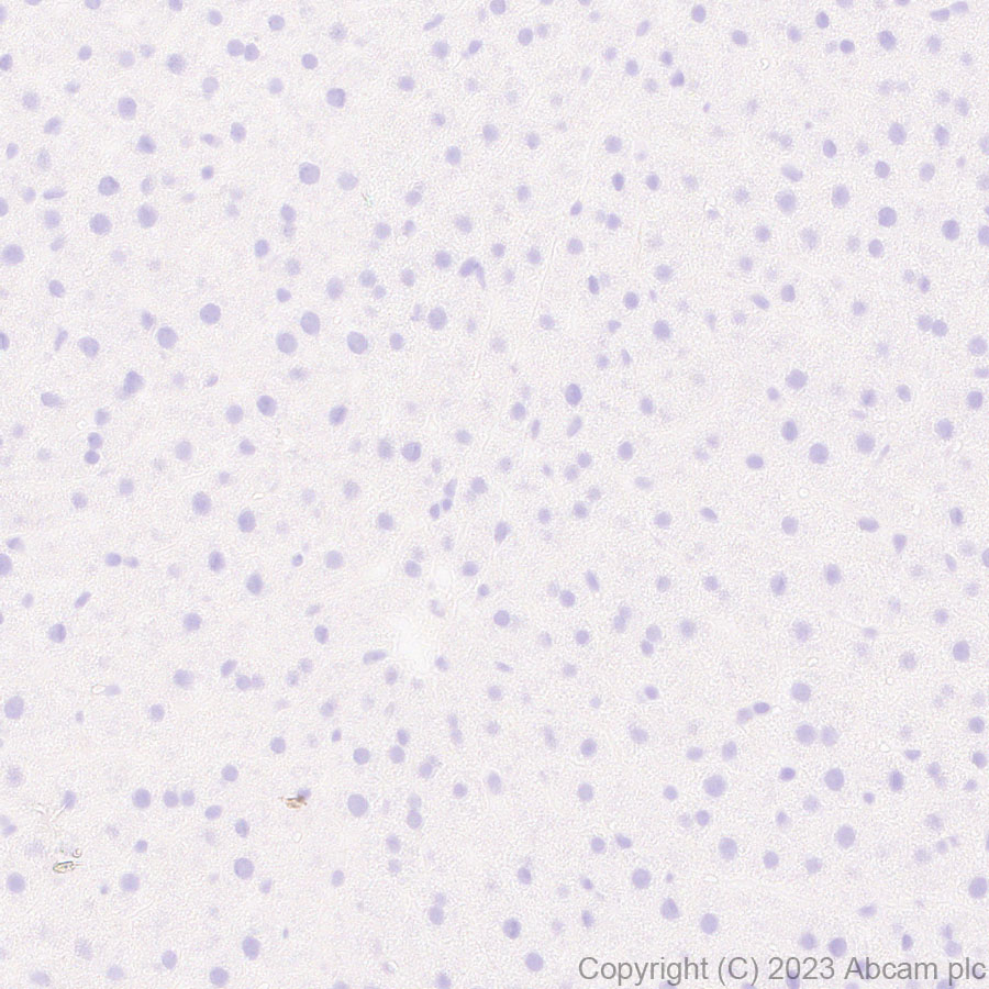 Immunohistochemistry (Formalin/PFA-fixed paraffin-embedded sections) - Anti-SLC12A1/NKCC2 antibody [EPR28176-90] (ab313640), expandable thumbnail