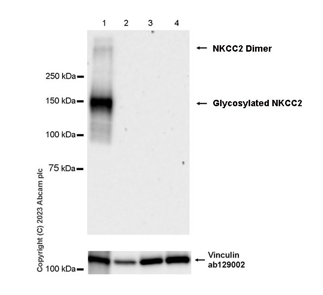 Western blot - Anti-SLC12A1/NKCC2 antibody [EPR28176-90] (AB313640), expandable thumbnail