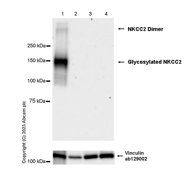 Western blot - Anti-SLC12A1/NKCC2 antibody [EPR28176-90] (AB313640)