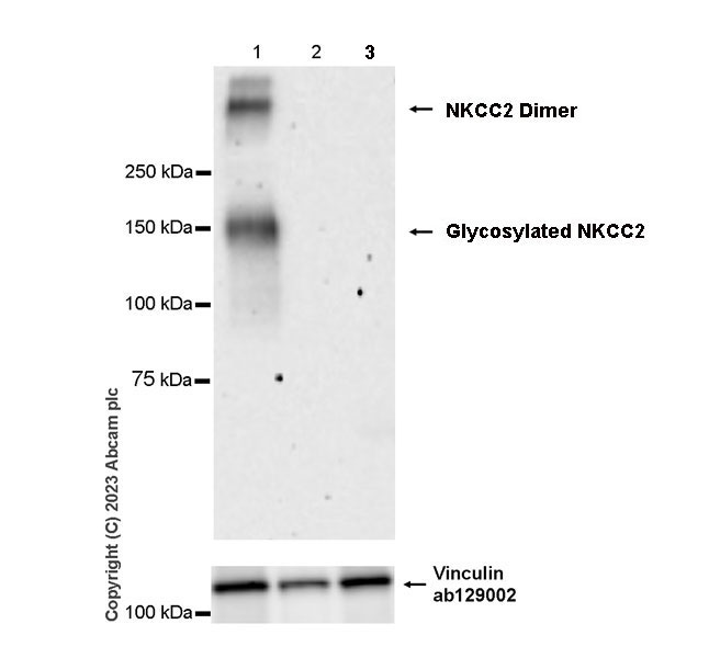 Western blot - Anti-SLC12A1/NKCC2 antibody [EPR28176-90] (ab313640), expandable thumbnail