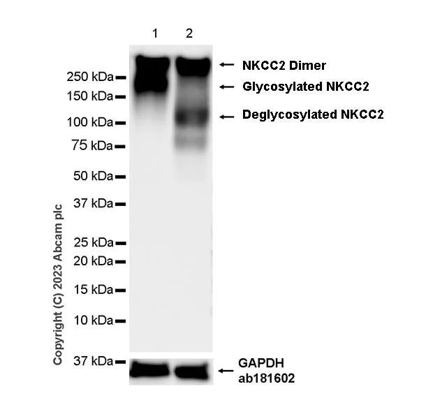 Western blot - Anti-SLC12A1/NKCC2 antibody [EPR28176-90] (AB313640)