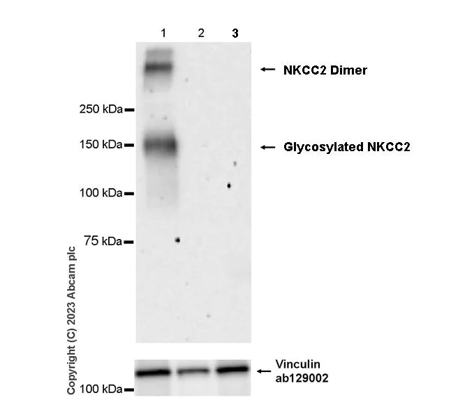 Western blot - Anti-SLC12A1/NKCC2 antibody [EPR28176-90] - BSA and Azide free (AB313641)