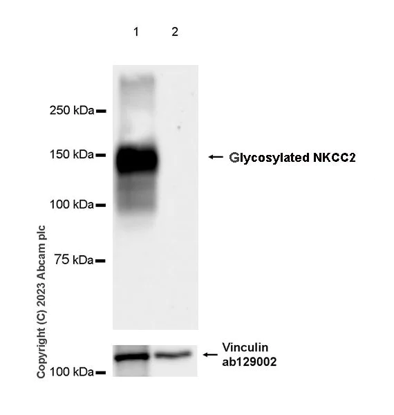 Western blot - Anti-SLC12A1/NKCC2 antibody [EPR28176-90] - BSA and Azide free (AB313641)
